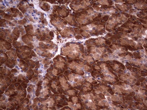 LGALS3 / Galectin 3 Antibody (clone OTI6E1)