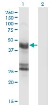GFAP Antibody (clone 8H3)