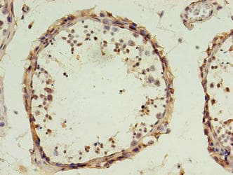 DPPA4 Antibody