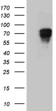 Monoclonal Mouse anti-Human CARD9 Antibody (clone OTI3F8, WB)