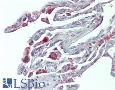 IHC-plus™ Polyclonal Rabbit anti-Human HNF1A / HNF1 Antibody (aa550-600, IHC, WB)
