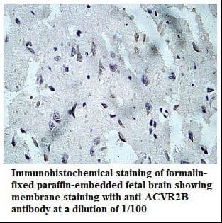 ACTRIIB / ACVR2B Antibody (aa22-264)