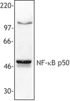 IHC-plus™ NFKB1 / NF-Kappa-B Antibody (clone 4D1)