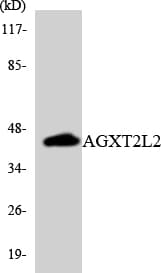 PHYKPL / AGXT2L2 Antibody (aa335-384)