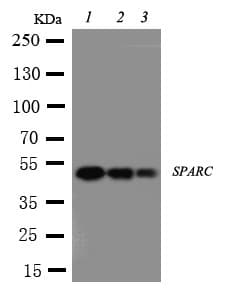 Polyclonal Rabbit anti-Human Osteonectin / SPARC Antibody (aa284-303, IHC, WB)