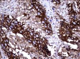 CD30 Antibody (clone OTI16H5)