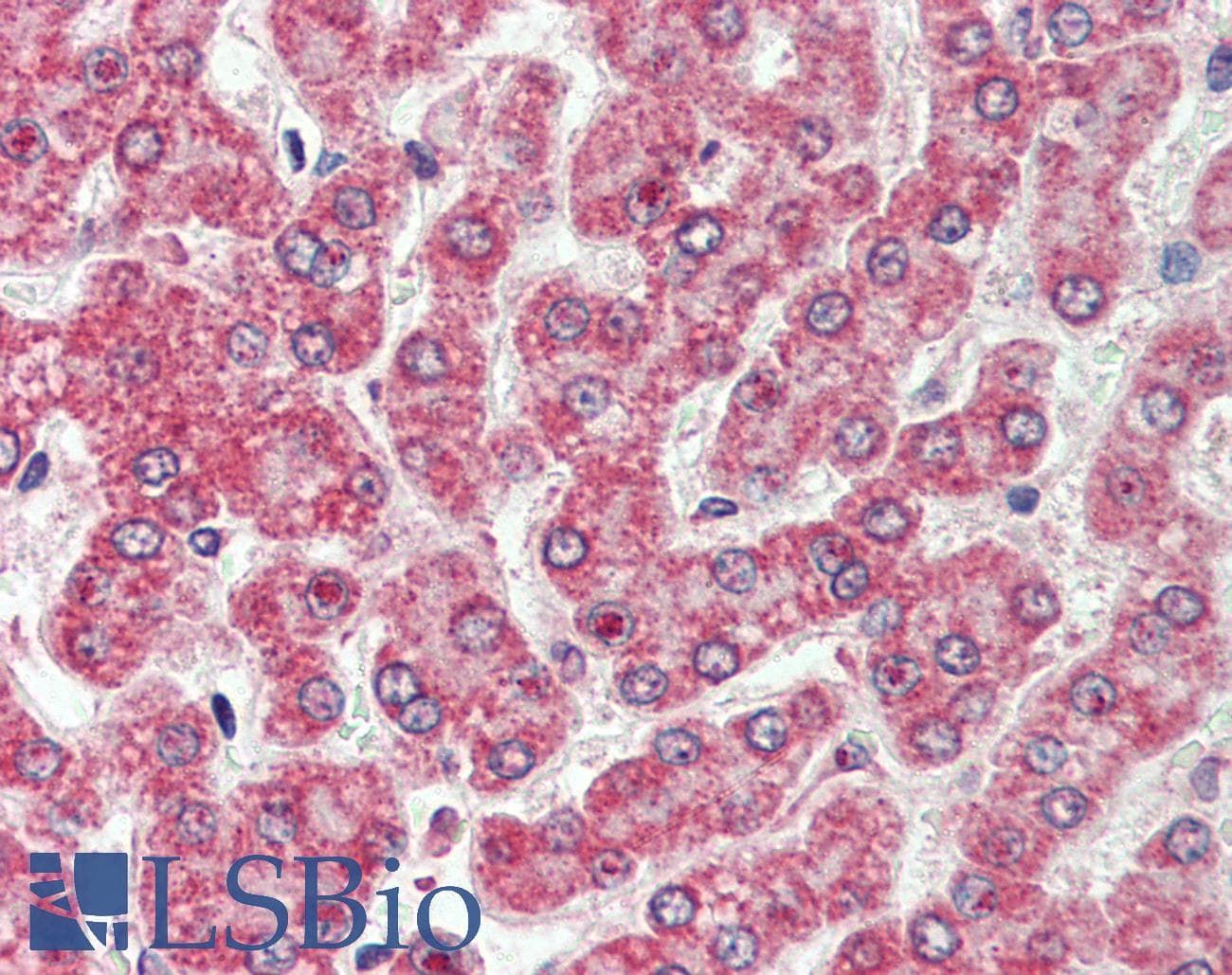 IHC-plus™ CXADR Antibody (Internal)