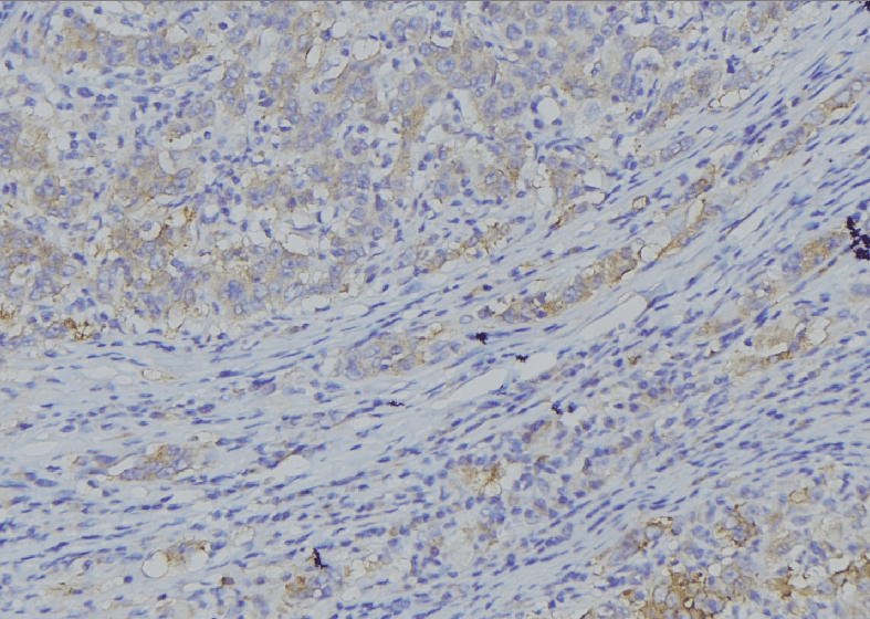 CYB5A / Cytochrome b5 Antibody