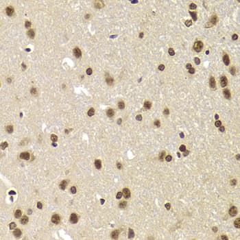 Polyclonal Rabbit anti-Human SNRPA / U1A Antibody (IHC, IF, WB)