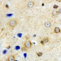 VILIP / VSNL1 Antibody