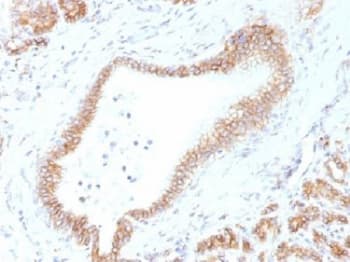 CTNNB1 / Beta Catenin Antibody (clone CTNNB1/1507)