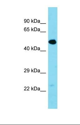 TMEM39A Antibody (aa351-400)