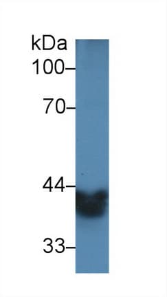 ADH1A / Alcohol Dehydrogenase Antibody (aa25-228)