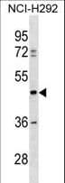 TULP3 Antibody (aa374-400)