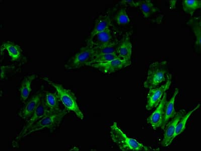 MPO / Myeloperoxidase Antibody