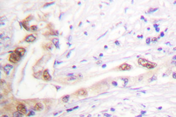 TOP2B / Topoisomerase II Beta Antibody (Ala32)