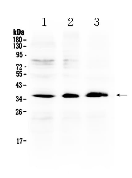 AKR1B10 Antibody