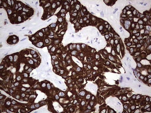 Monoclonal Rat anti-Human Acidic Cytokeratin Antibody (clone 9H3, IHC)