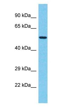 TBX20 Antibody (C-Terminus)
