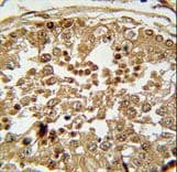 Polyclonal Rabbit anti-Human SPAG1 / TPIS Antibody (aa124-152, IHC, WB)