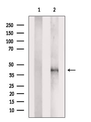PDLIM3 Antibody