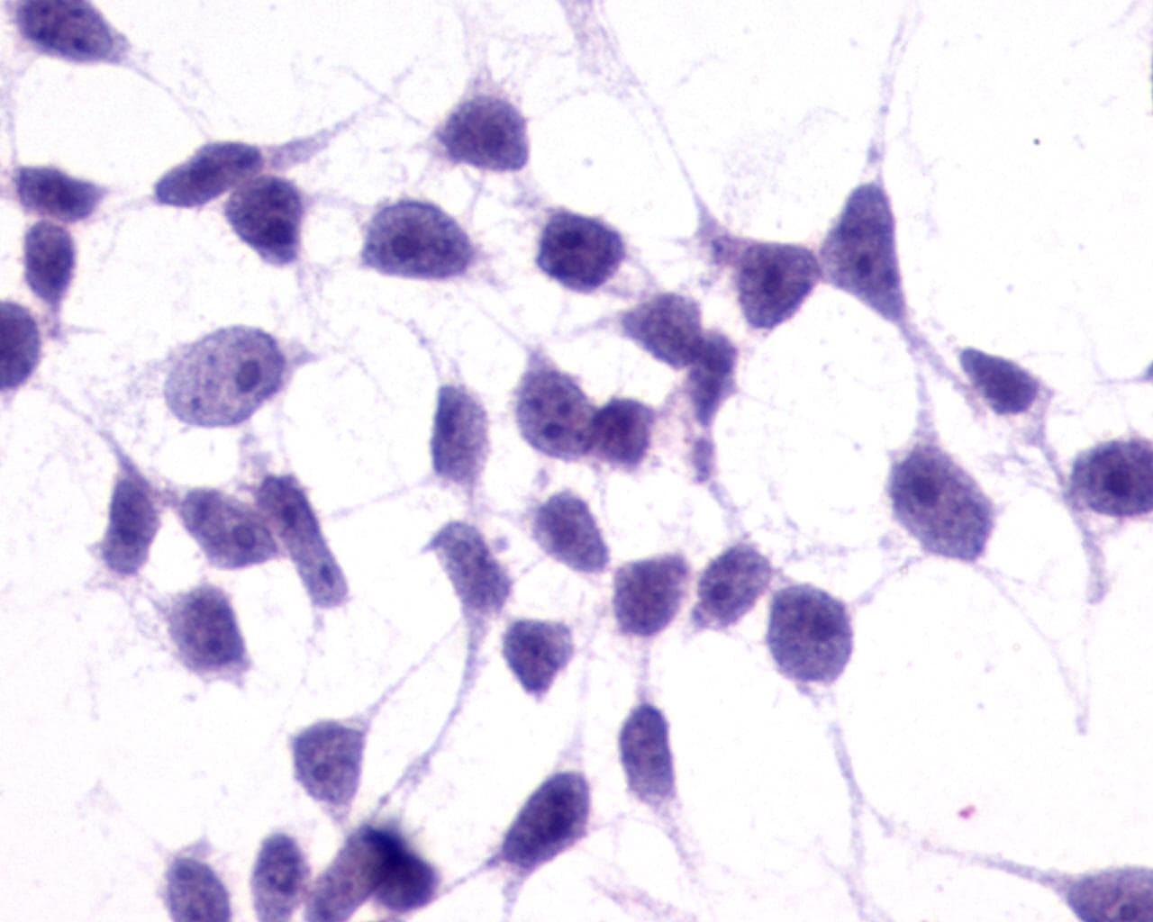 PathPlus™ GRM3 / MGLUR3 Antibody (N-Terminus)