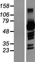 NCF2 / NOXA2 / p67phox Protein (Over-Expression Lysate Myc-DDK (Flag))