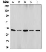 DFFA / ICAD / DFF45 Antibody (Internal)
