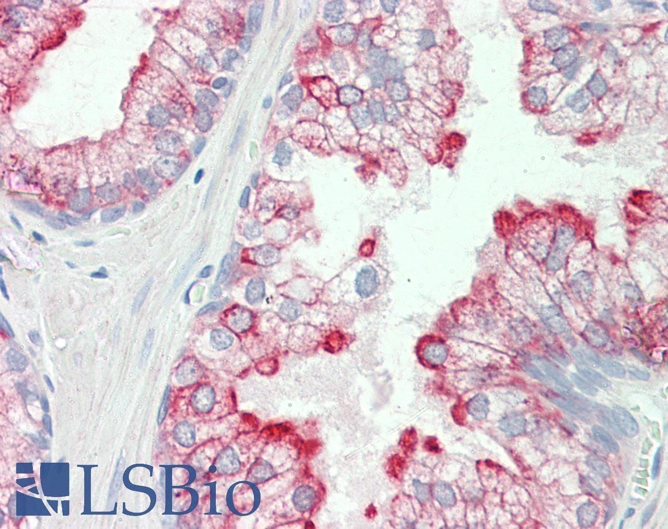 IHC-plus™ HRH3 / Histamine 3 Receptor Antibody (aa135-149)