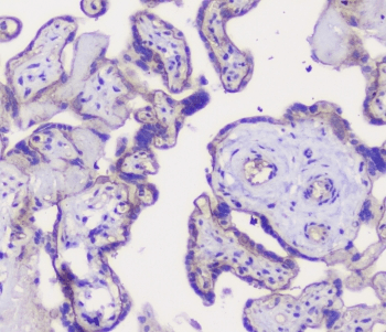 CDH3 / P-Cadherin Antibody