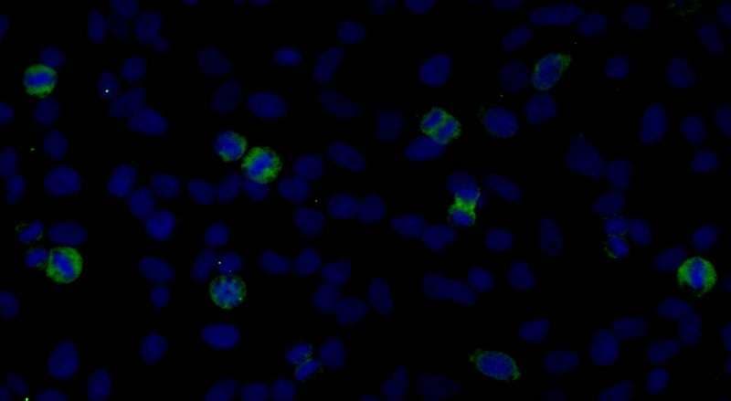 Polyclonal Rabbit anti-Human CENPF / CENP-F Antibody (aa1800-1850, IF)