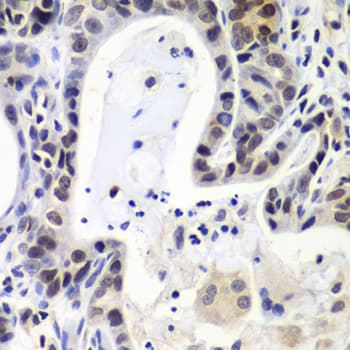 LSM2 / SnRNP Antibody
