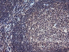 PGAM2 Antibody (clone OTI1C1)