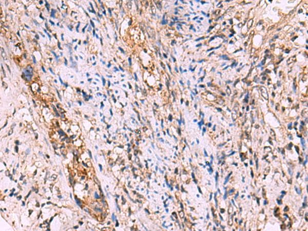 GALK2 Antibody