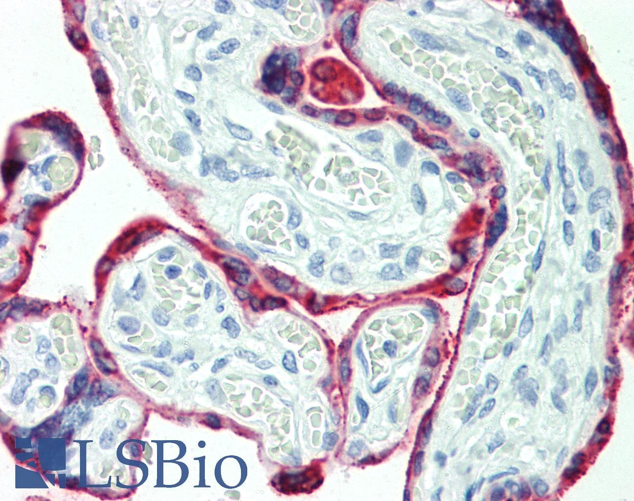 IHC-plus™ HSD3B1 Antibody (clone 3C11-D4)