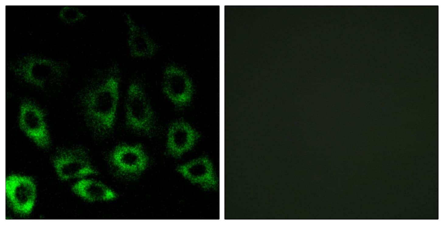 MBTPS2 Antibody (aa301-350)