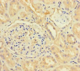 Polyclonal Rabbit anti-Human CX3CL1 / Fractalkine Antibody (WB)