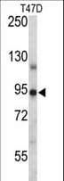 PR / Progesterone Receptor Antibody (aa349-377)