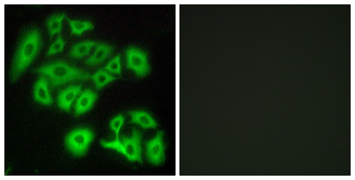 Polyclonal Rabbit anti-Human FZD4 / Frizzled 4 Antibody (aa131-180, IF)