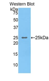 OSTF1 / OSF Antibody (aa12-214)
