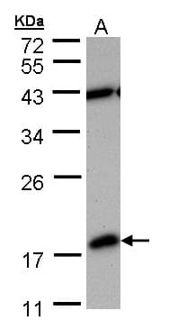 Polyclonal Rabbit anti-Human PDE6D / PDE6 Delta Antibody (aa1-150, IHC, WB)