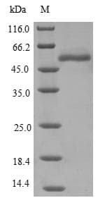 Human EPHX1 / Epoxide Hydrolase 1 Protein (Recombinant 6His, N-terminus)