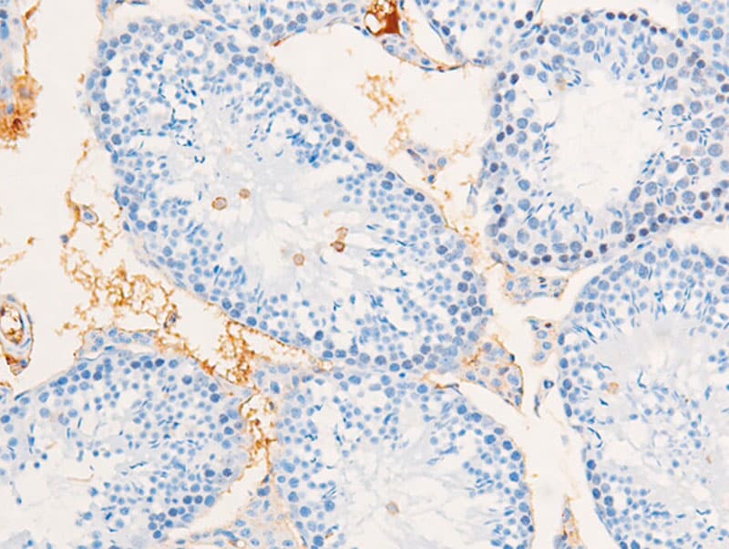 EGFR Antibody (phospho-Ser695)