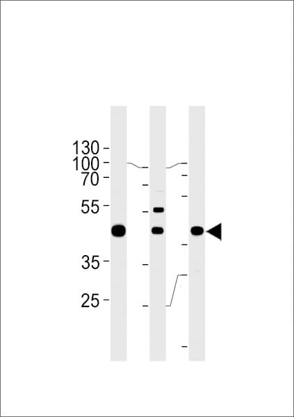 GTF2H2C Antibody (aa314-343)