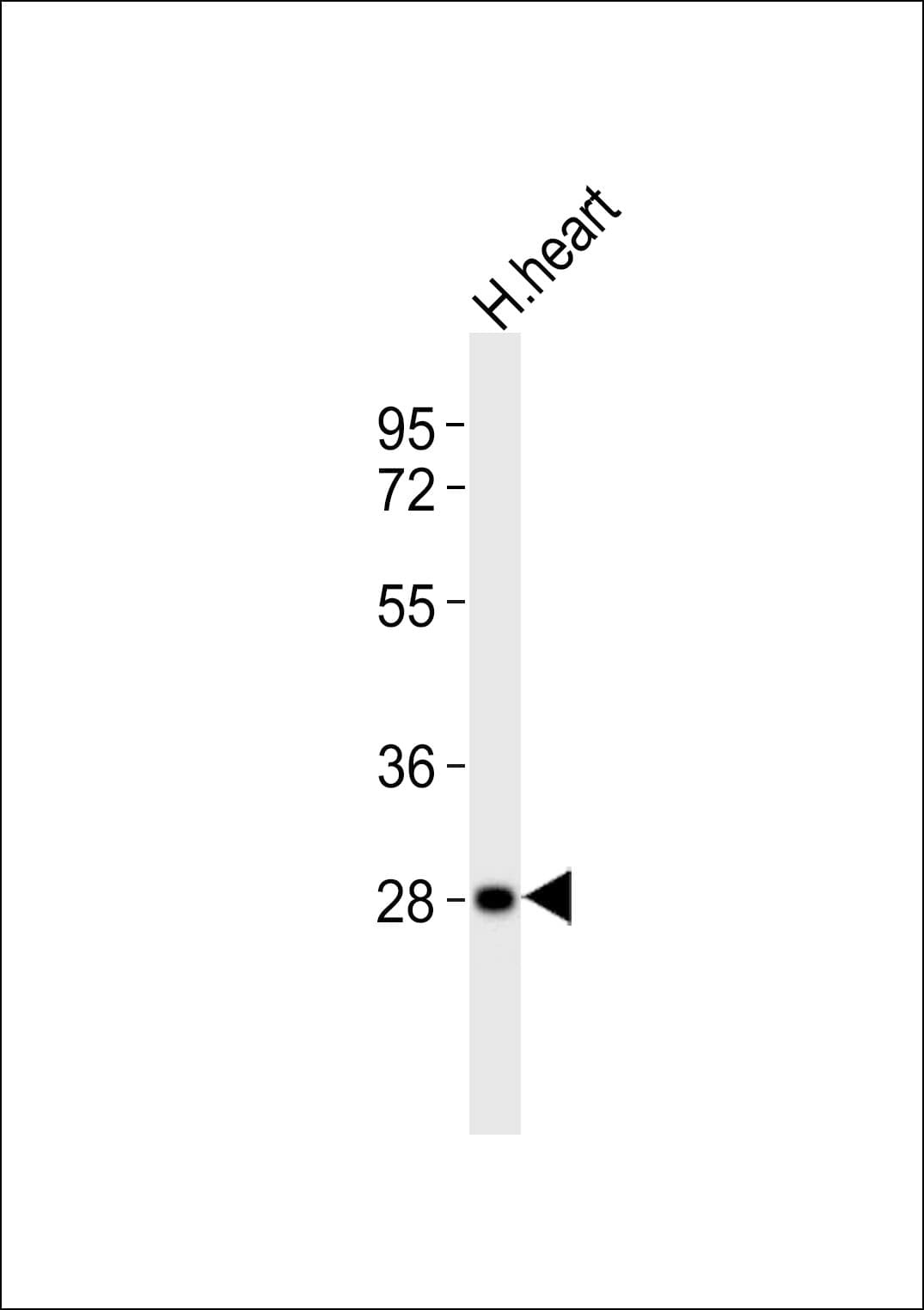 RRAD Antibody