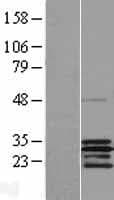 SCO2 Protein (Over-Expression Lysate Myc-DDK (Flag))