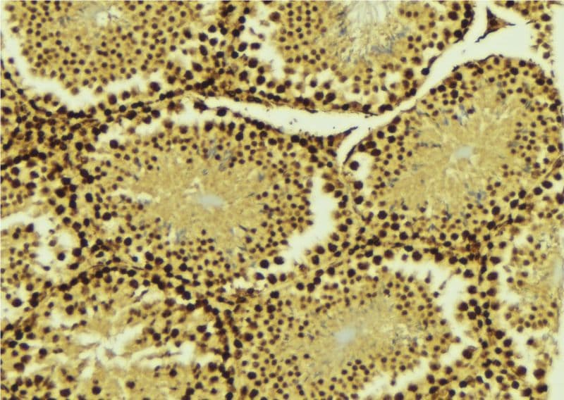 PIAS4 / PIASY Antibody