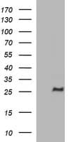 CHAC1 / MGC4504 Antibody (clone OTI4A11)