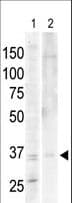 Polyclonal Rabbit anti-Human PRKACA + PRKACB Antibody (aa9-40, IHC, WB)