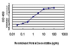 ZIC4 Antibody (clone 1A9)